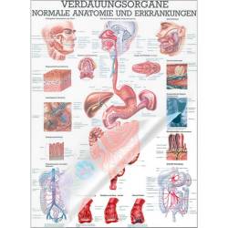 Verdauungsorgane - normale Anatomie u.  Erkrankungen Lehrtafel 70 x 100 cm | laminiert