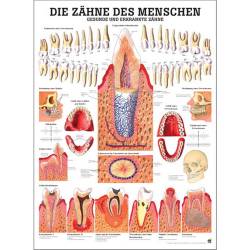 Die Zähne des Menschen Lehrtafel 70 x 100 cm | unlaminiert