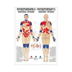 "Physiotherapie I-IX" Physiotherapie II-Thermotherapie | Mini-Poster 24 x 34 cm | unlaminiert