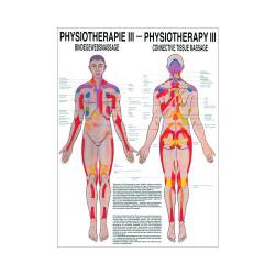 "Physiotherapie I-IX" Physiotherapie III-Bindegewebsmassage | Mini-Poster 24 x 34 cm | unlaminiert
